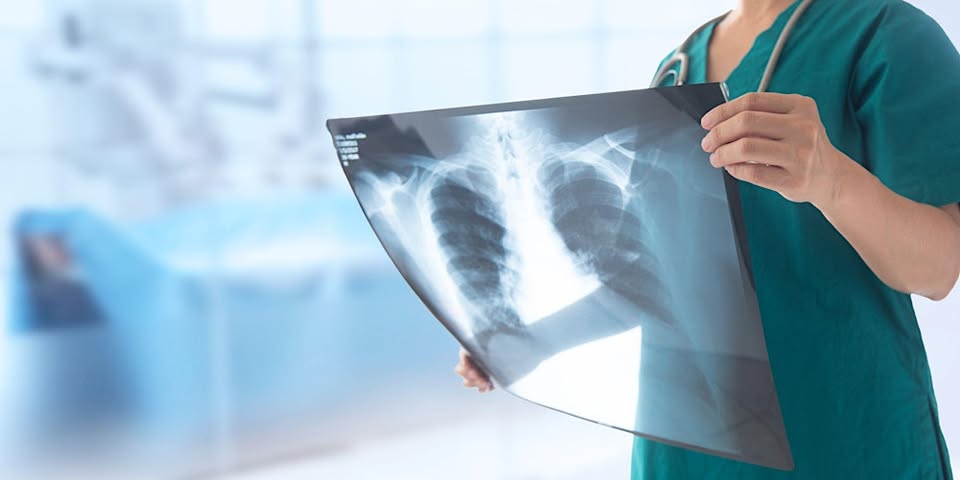 X-Ray View